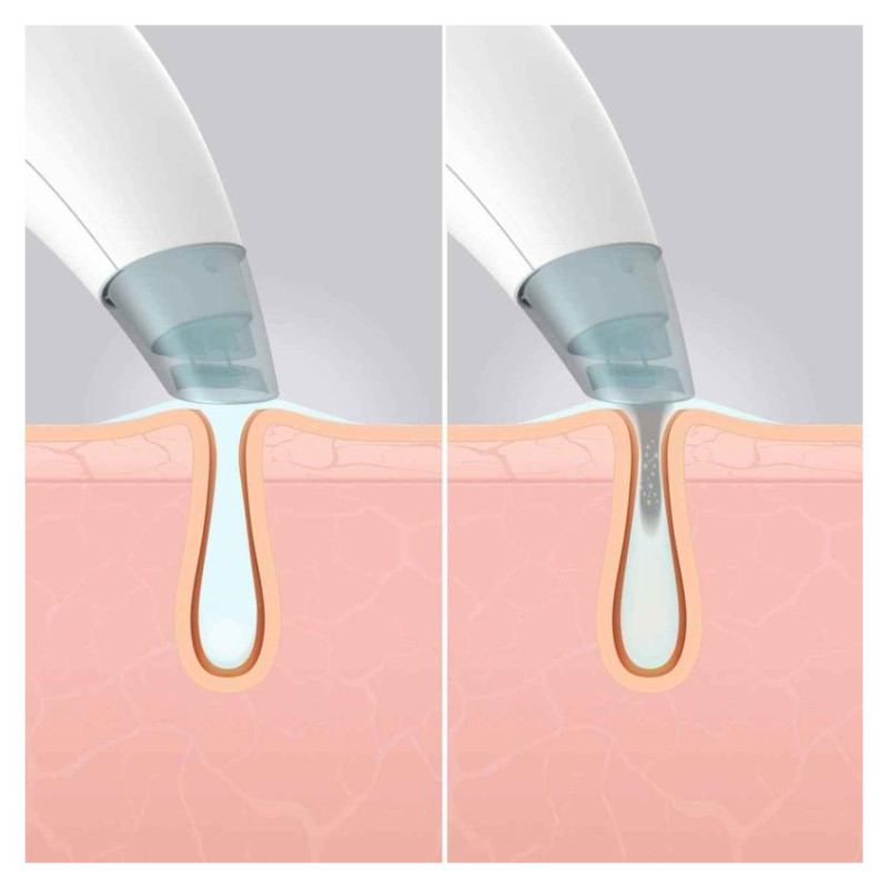 Homedics FAC-HY100 Refresh Hydra Facial