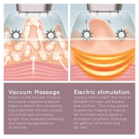 Homedics CELL-500-EU Smoothee Anti Cellulite Vacuum Massage Skin Smoother