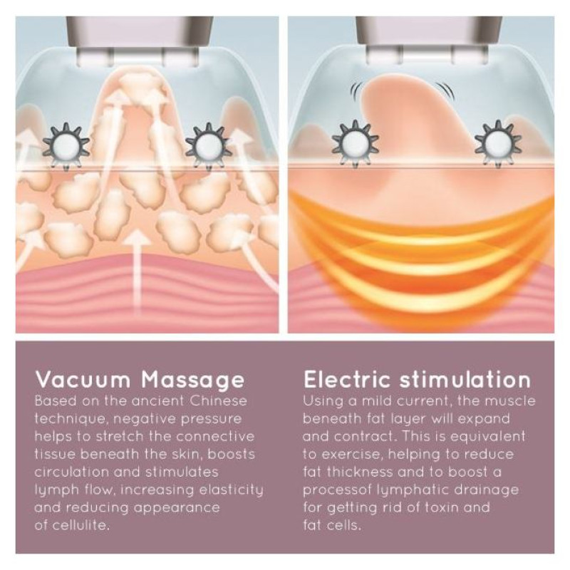 Homedics CELL-500-EU Smoothee Anti Cellulite Vacuum Massage Skin Smoother