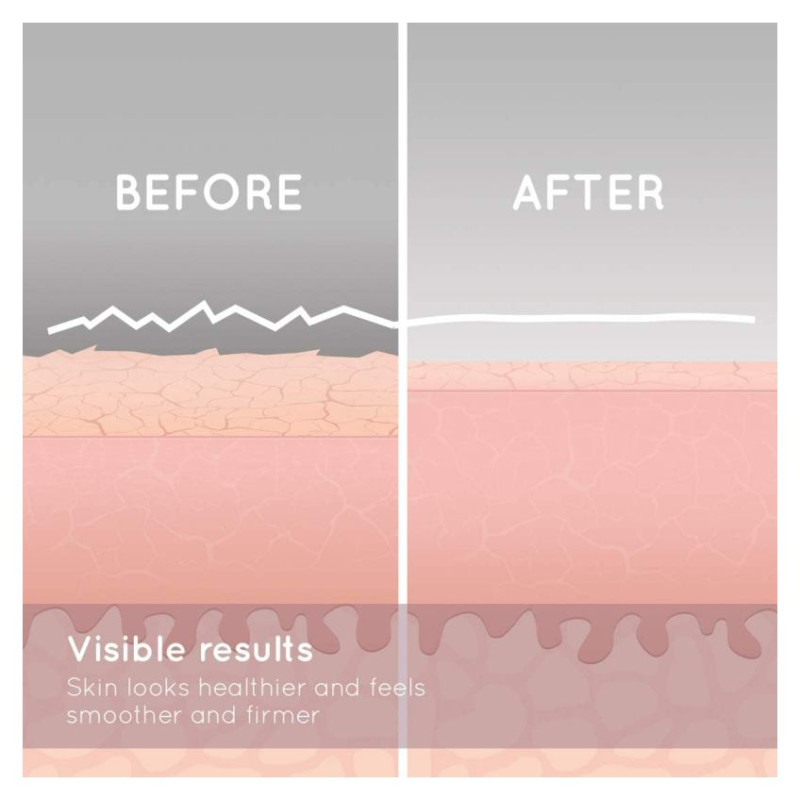 Homedics MDA-100RGA Radiance