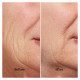 Silkn FaceTite Revive FTC1PE1001